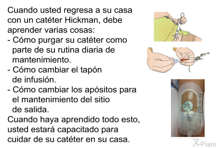 Cuando usted regresa a su casa con un catter Hickman, debe aprender varias cosas:  Cmo purgar su catter como parte de su rutina diaria de mantenimiento Cmo cambiar el tapn de infusin. Cmo cambiar los apsitos para el mantenimiento del sitio de salida.  
 Cuando haya aprendido todo esto, usted estar capacitado para cuidar de su catter en su casa.