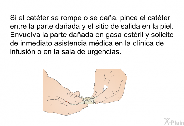 Si el catter se rompe o se daa, pince el catter entre la parte daada y el sitio de salida en la piel. Envuelva la parte daada en gasa estril y solicite de inmediato asistencia mdica en la clnica de infusin o en la sala de urgencias.