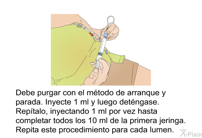 Debe purgar con el mtodo de arranque y parada. Inyecte 1 ml y luego detngase. Reptalo, inyectando 1 ml por vez hasta completar todos los 10 ml de la primera jeringa. Repita este procedimiento para cada lumen.