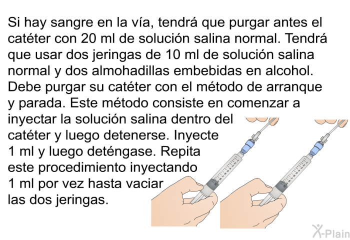 Si hay sangre en la va, tendr que purgar antes el catter con 20 ml de solucin salina normal. <B>Tendr que usar dos jeringas de 10 ml de solucin salina normal y dos almohadillas embebidas en alcohol</B>. Debe purgar su catter con el mtodo de arranque y parada. Este mtodo consiste en comenzar a inyectar la solucin salina dentro del catter y luego detenerse. Inyecte 1 ml y luego detngase. <B>Repita este procedimiento inyectando 1 ml por vez hasta vaciar las dos jeringas.</B>