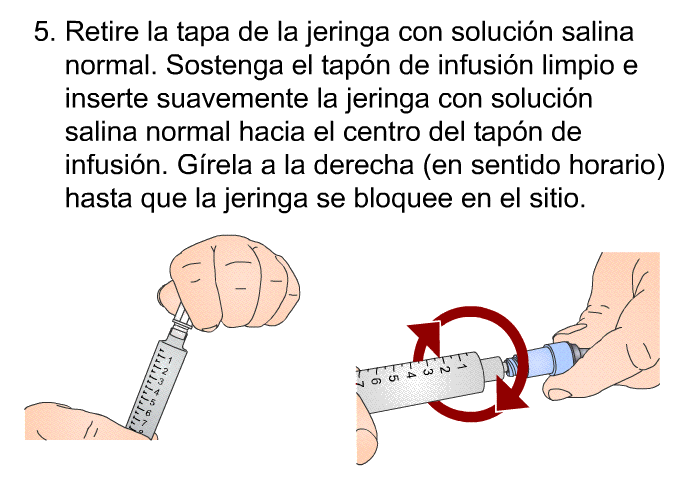 Retire la tapa de la jeringa con soluci�n salina normal. Sostenga el tap�n de infusi�n limpio e inserte suavemente la jeringa con soluci�n salina normal hacia el centro del tap�n de infusi�n. G�rela a la derecha (en sentido horario) hasta que la jeringa se bloquee en el sitio.