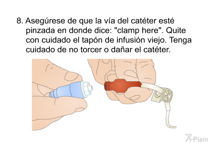 Aseg�rese de que la v�a del cat�ter est� pinzada en donde dice: &ldquo;clamp here&rdquo;. Quite con cuidado el tap�n de infusi�n viejo. Tenga cuidado de no torcer o da�ar el cat�ter.