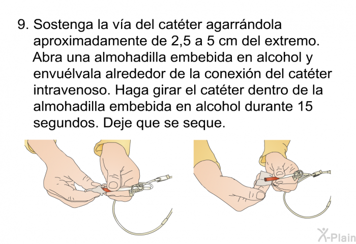 Sostenga la v�a del cat�ter agarr�ndola aproximadamente de 2,5 a 5 cm del extremo. Abra una almohadilla embebida en alcohol y envu�lvala alrededor de la conexi�n del cat�ter intravenoso. Haga girar el cat�ter dentro de la almohadilla embebida en alcohol durante 15 segundos. Deje que se seque.