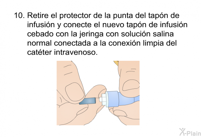 Retire el protector de la punta del tap�n de infusi�n y conecte el nuevo tap�n de infusi�n cebado con la jeringa con soluci�n salina normal conectada a la conexi�n limpia del cat�ter intravenoso.
