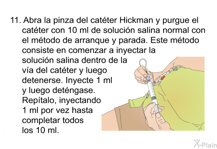 Abra la pinza del cat�ter Hickman y purgue el cat�ter con 10 ml de soluci�n salina normal con el m�todo de arranque y parada. Este m�todo consiste en comenzar a inyectar la soluci�n salina dentro de la v�a del cat�ter y luego detenerse. Inyecte 1 ml y luego det�ngase. Rep�talo, inyectando 1 ml por vez hasta completar todos los 10 ml.
