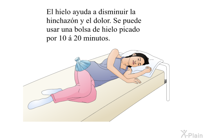 El hielo ayuda a disminuir la hinchaz�n y el dolor. Se puede usar una bolsa de hielo picado por 10 �<I> </I>20 minutos.