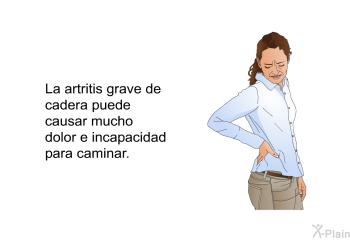 La artritis grave de cadera puede causar mucho dolor e incapacidad para caminar.