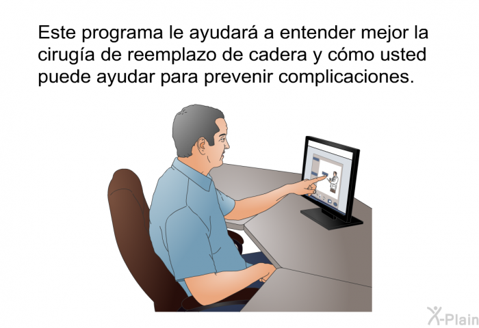 Esta informacin acerca de su salud le ayudar a entender mejor la ciruga de reemplazo de cadera y cmo usted puede ayudar para prevenir complicaciones.