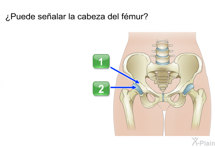 ¿Puede sealar la cabeza del fmur?