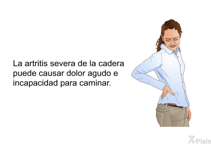 La artritis severa de la cadera puede causar dolor agudo e incapacidad para caminar.