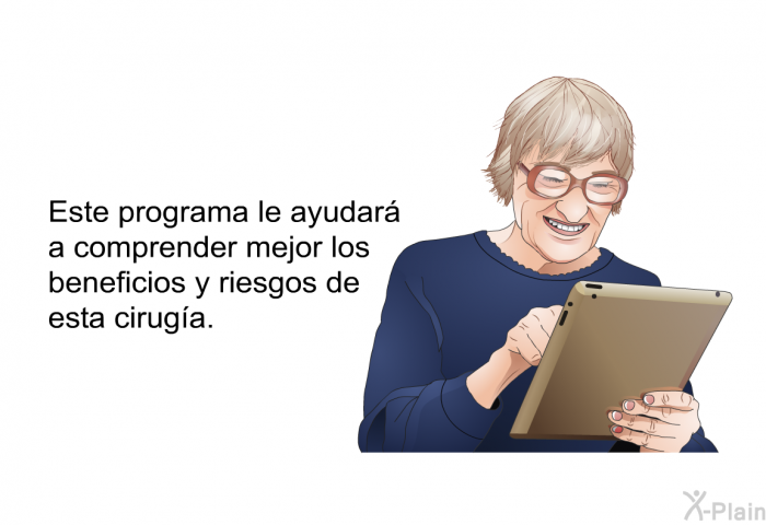 Esta informacin acerca de su salud le ayudar a comprender mejor los beneficios y riesgos de esta ciruga.