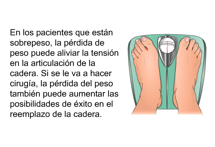 En los pacientes que est�n sobrepeso, la p�rdida de peso puede aliviar la tensi�n en la articulaci�n de la cadera. Si se le va a hacer cirug�a, la p�rdida del peso tambi�n puede aumentar las posibilidades de �xito en el reemplazo de la cadera.