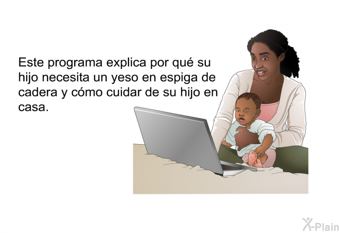 Esta informacin acerca de su salud explica por qu su hijo necesita un yeso en espiga de cadera y cmo cuidar de su hijo en casa.