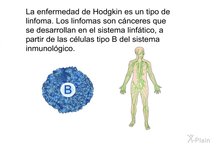 La enfermedad de Hodgkin es un tipo de linfoma. Los linfomas son cnceres que se desarrollan en el sistema linftico, a partir de las clulas tipo B del sistema inmunolgico.