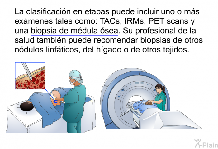 La clasificacin en etapas puede incluir uno o ms exmenes tales como: TACs, IRMs, PET scans y una biopsia de mdula sea. Su profesional de la salud tambin puede recomendar biopsias de otros ndulos linfticos, del hgado o de otros tejidos.