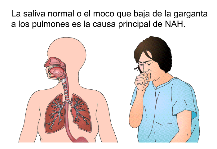 La saliva normal o el moco que baja de la garganta a los pulmones es la causa principal de NAH.