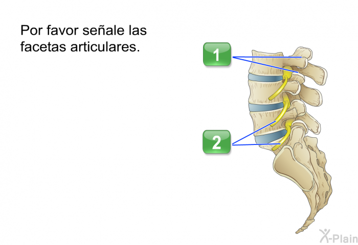 Por favor seale las facetas articulares.