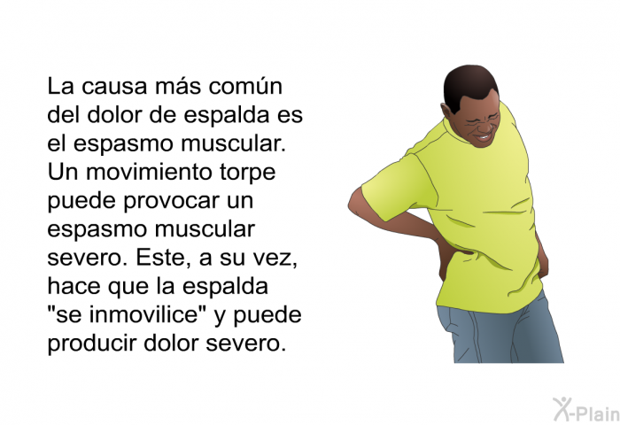La causa ms comn del dolor de espalda es el espasmo muscular. Un movimiento torpe puede provocar un espasmo muscular severo. Este, a su vez, hace que la espalda “se inmovilice” y puede producir dolor severo.