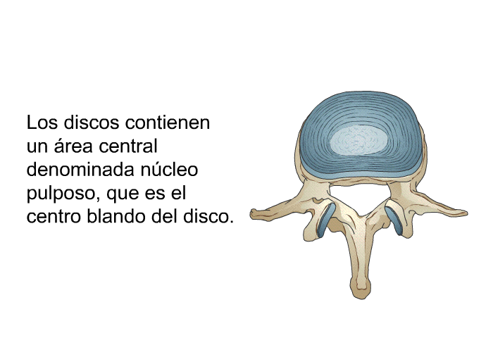 Los discos contienen un �rea central denominada n�cleo pulposo, que es el centro blando del disco.