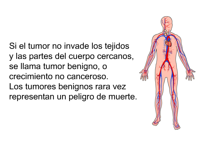 Si el tumor no invade los tejidos y las partes del cuerpo cercanos, se llama tumor benigno, o crecimiento no canceroso. Los tumores benignos rara vez representan un peligro de muerte.