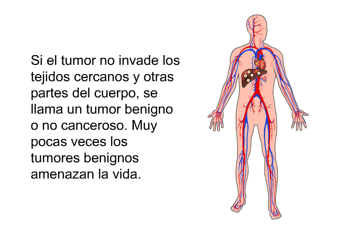 Si el tumor no invade los tejidos cercanos y otras partes del cuerpo, se llama un tumor benigno o no canceroso. Muy pocas veces los tumores benignos amenazan la vida.