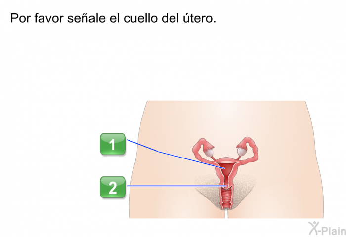 Por favor seale el cuello del tero.