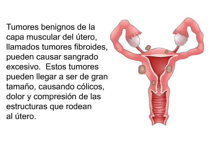 Tumores benignos de la capa muscular del tero, llamados tumores fibroides, pueden causar sangrado excesivo. Estos tumores pueden llegar a ser de gran tamao, causando clicos, dolor y compresin de las estructuras que rodean al tero.