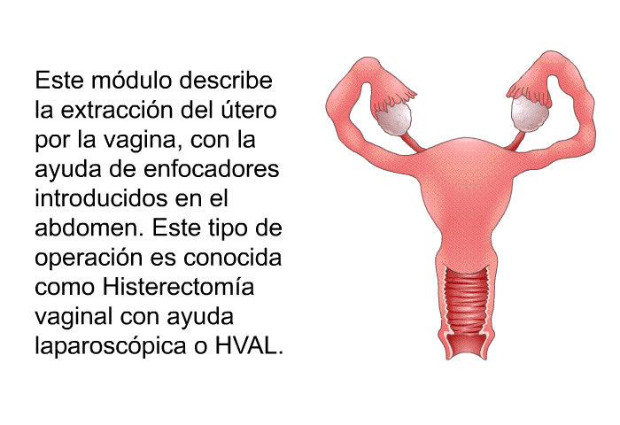 Este m�dulo describe la extracci�n del �tero por la vagina, con la ayuda de enfocadores introducidos en el abdomen. Este tipo de operaci�n es conocida como Histerectom�a vaginal con ayuda laparosc�pica o HVAL.