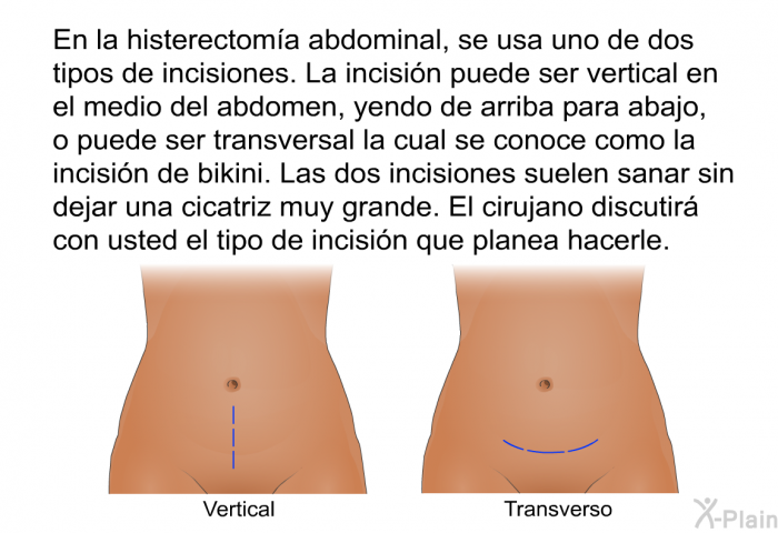 En la histerectom�a abdominal, se usa uno de dos tipos de incisiones. La incisi�n puede ser vertical en el medio del abdomen, yendo de arriba para abajo, o puede ser transversal la cual se conoce como la incisi�n de bikini. Las dos incisiones suelen sanar sin dejar una cicatriz muy grande. El cirujano discutir� con usted el tipo de incisi�n que planea hacerle.