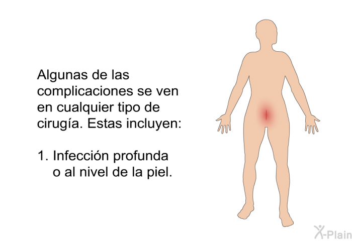 Algunas de las complicaciones se ven en cualquier tipo de ciruga. Estas incluyen:  Infeccin profunda o al nivel de la piel.
