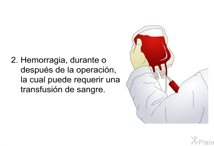 Hemorragia, durante o despus de la operacin, la cual puede requerir una transfusin de sangre.