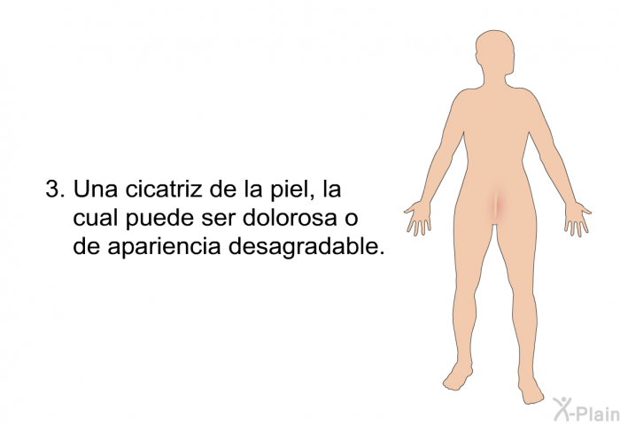 Una cicatriz de la piel, la cual puede ser dolorosa o de apariencia desagradable.