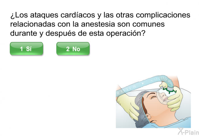 ¿Los ataques cardacos y las otras complicaciones relacionadas con la anestesia son comunes durante y despus de esta operacin?
