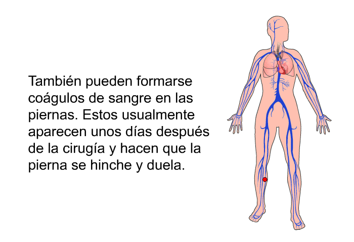 Tambin pueden formarse cogulos de sangre en las piernas. Estos usualmente aparecen unos das despus de la ciruga y hacen que la pierna se hinche y duela.