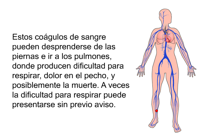 Estos cogulos de sangre pueden desprenderse de las piernas e ir a los pulmones, donde producen dificultad para respirar, dolor en el pecho, y posiblemente la muerte. A veces la dificultad para respirar puede presentarse sin previo aviso.