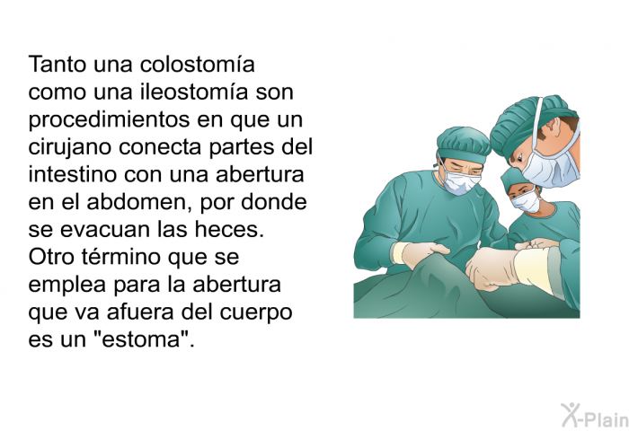 Tanto una colostoma como una ileostoma son procedimientos en que un cirujano conecta partes del intestino con una abertura en el abdomen, por donde se evacuan las heces. Otro trmino que se emplea para la abertura que va afuera del cuerpo es un “estoma”.