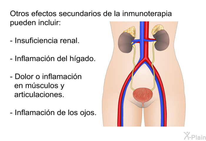 Otros efectos secundarios de la inmunoterapia pueden incluir:  Insuficiencia renal. Inflamaci�n del h�gado. Dolor o inflamaci�n en m�sculos y articulaciones. Inflamaci�n de los ojos.