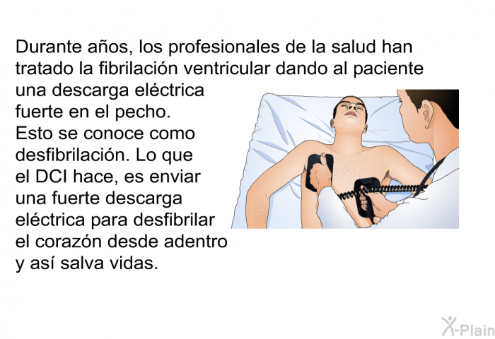 Durante aos, los profesionales de la salud han tratado la fibrilacin ventricular dando al paciente una descarga elctrica fuerte en el pecho.  Esto se conoce como desfibrilacin. Lo que el DCI hace, es enviar una fuerte descarga elctrica para desfibrilar el corazn desde adentro y as salva vidas.