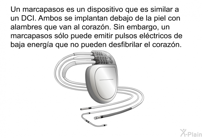 Un marcapasos es un dispositivo que es similar a un DCI. Ambos se implantan debajo de la piel con alambres que van al corazn. Sin embargo, un marcapasos slo puede emitir pulsos elctricos de baja energa que no pueden desfibrilar el corazn.