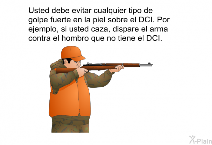 Usted debe evitar cualquier tipo de golpe fuerte en la piel sobre el DCI. Por ejemplo, si usted caza, dispare el arma contra el hombro que no tiene el DCI.