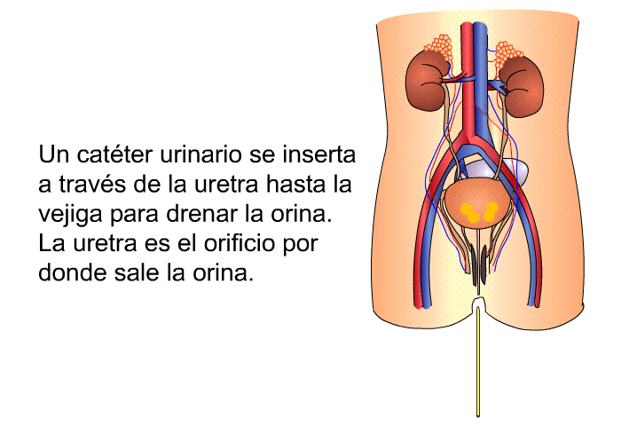 Un catter urinario se inserta a travs de la uretra hasta la vejiga para drenar la orina. La uretra es el orificio por donde sale la orina.