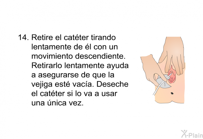 <OL START=14> Retire el catter tirando lentamente de l con un movimiento descendiente. Retirarlo lentamente ayuda a asegurarse de que la vejiga est vaca. Deseche el catter si lo va a usar una nica vez.