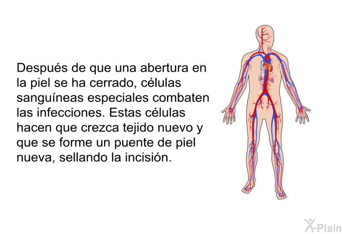 Despus de que una abertura en la piel se ha cerrado, clulas sanguneas especiales combaten las infecciones. Estas clulas hacen que crezca tejido nuevo y que se forme un puente de piel nueva, sellando la incisin.