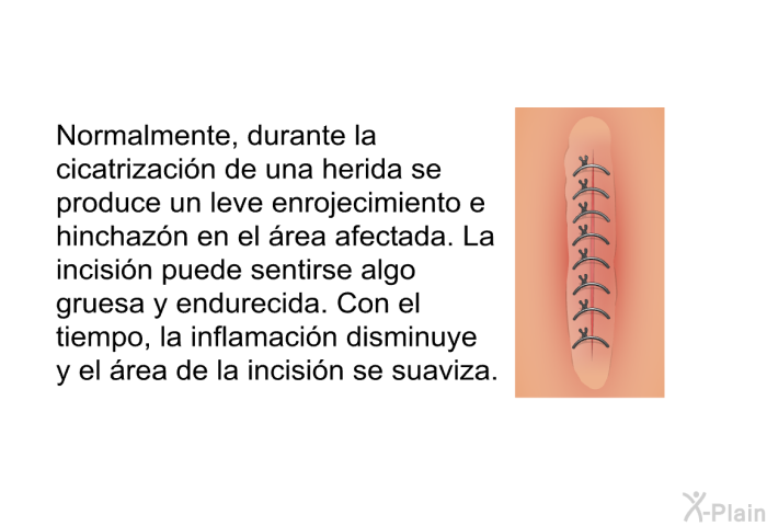 Normalmente, durante la cicatrizacin de una herida se produce un leve enrojecimiento e hinchazn en el rea afectada. La incisin puede sentirse algo gruesa y endurecida. Con el tiempo, la inflamacin disminuye y el rea de la incisin se suaviza.