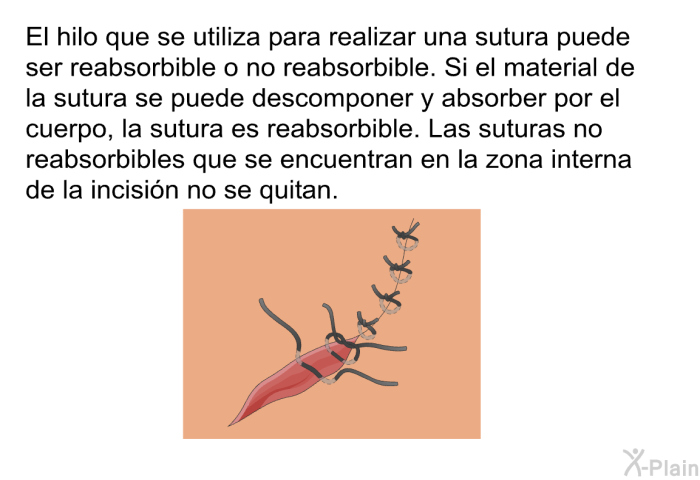 El hilo que se utiliza para realizar una sutura puede ser reabsorbible o no reabsorbible. Si el material de la sutura se puede descomponer y absorber por el cuerpo, la sutura es reabsorbible. Las suturas no reabsorbibles que se encuentran en la zona interna de la incisin no se quitan.