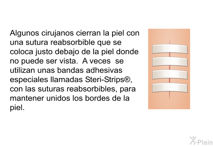 Algunos cirujanos cierran la piel con una sutura reabsorbible que se coloca justo debajo de la piel donde no puede ser vista. A veces se utilizan unas bandas adhesivas especiales llamadas Steri-Strips , con las suturas reabsorbibles, para mantener unidos los bordes de la piel.