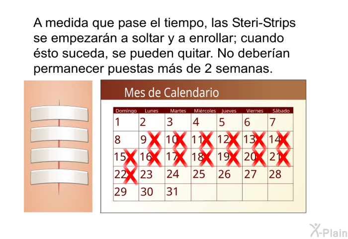 A medida que pase el tiempo, las Steri-Strips se empezarn a soltar y a enrollar; cuando sto suceda, se pueden quitar. No deberan permanecer puestas ms de 2 semanas.