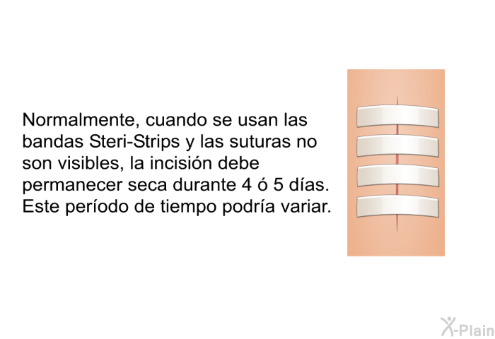 Normalmente, cuando se usan las bandas Steri-Strips y las suturas no son visibles, la incisin debe permanecer seca durante 4  5 das. Este perodo de tiempo podra variar.