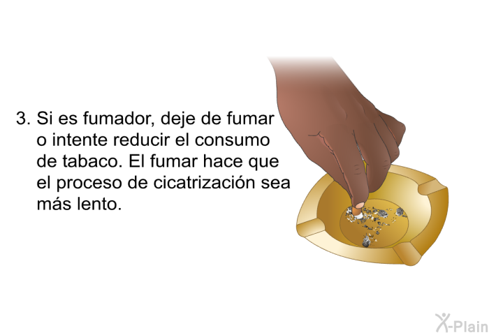 Si es fumador, deje de fumar o intente reducir el consumo de tabaco. El fumar hace que el proceso de cicatrizacin sea ms lento.