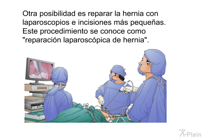 Otra posibilidad es reparar la hernia con laparoscopios e incisiones m�s peque�as. Este procedimiento se conoce como &ldquo;reparaci�n laparosc�pica de hernia&rdquo;.